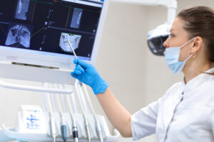 上顎の骨の高さをCTで確認する歯科医師